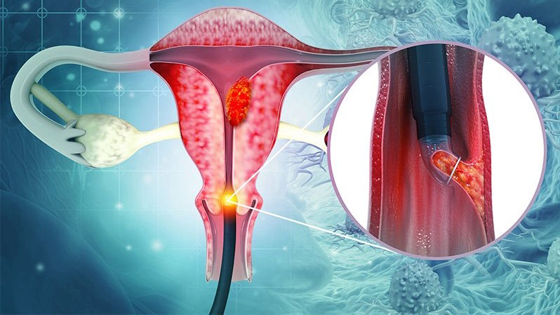 Cường kinh là gì? Nguyên nhân, triệu chứng, cách điều trị và phòng ngừa 1