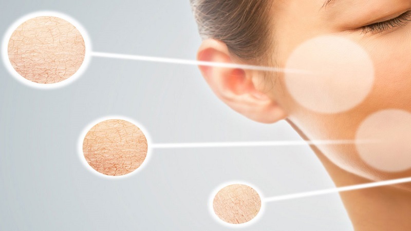 Da khô thiếu chất gì? Cách khắc phục hiệu quả 1