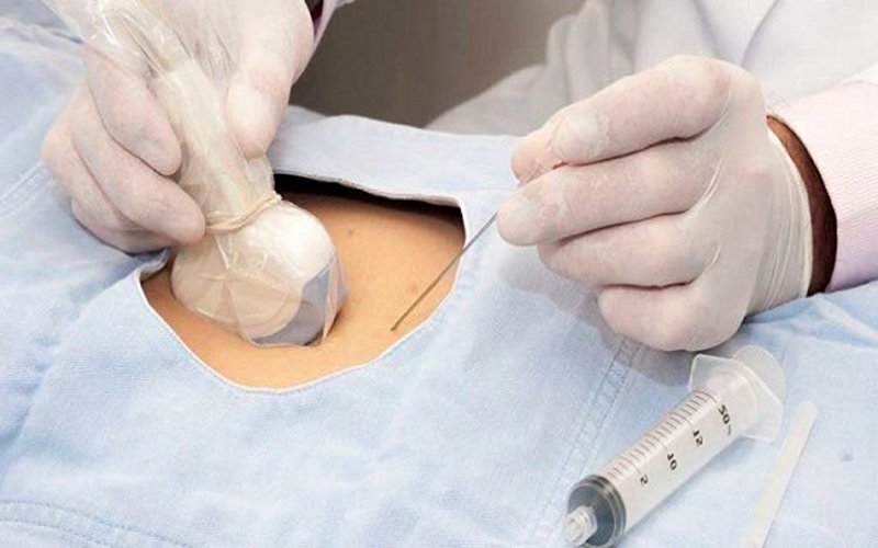 Đa ối khi mang thai có nguy hiểm không? 4