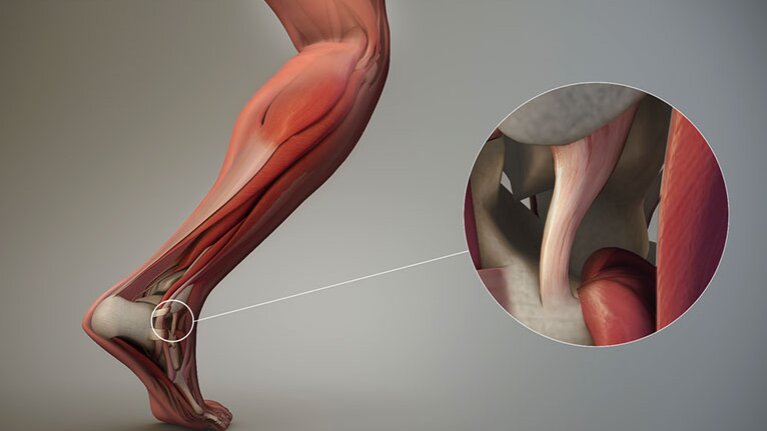 dac-diem-cau-tao-cua-day-chang-va-nhung-chan-thuong-lien-quan 1.jpg