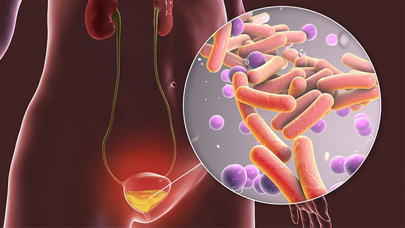 Đặc điểm giải phẫu bàng quang 3