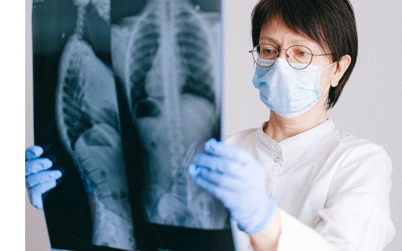 Đang cho con bú có chụp X-quang được không đang là thắc mắc của khá nhiều bà mẹ