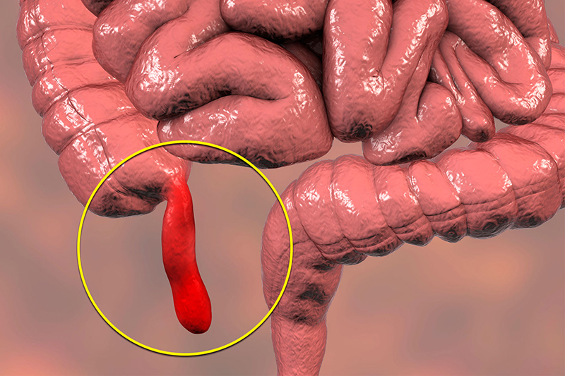 Thắc mắc: Đau bụng bên phải ngang rốn là dấu hiệu của bệnh gì? Cách xử lý khi bị đau bụng bên phải ngang rốn 4