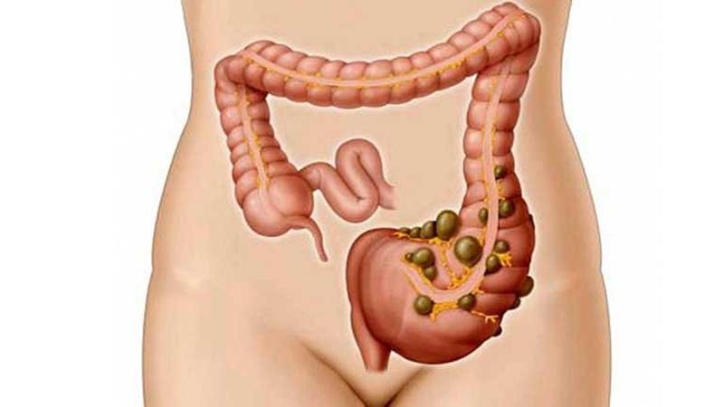 Đau bụng bên trái: Những nguyên nhân thường gặp và cách xử lý 2