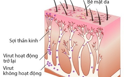 Đau dây thần kinh sau zona có thể điều trị bằng những loại thuốc nào? 2