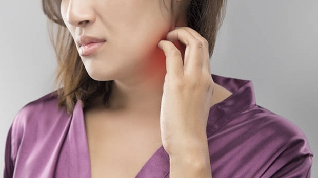 Đau dây thần kinh sau zona có thể điều trị bằng những loại thuốc nào? 3