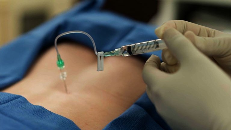 Đau dây thần kinh sau zona có thể điều trị bằng những loại thuốc nào? 6