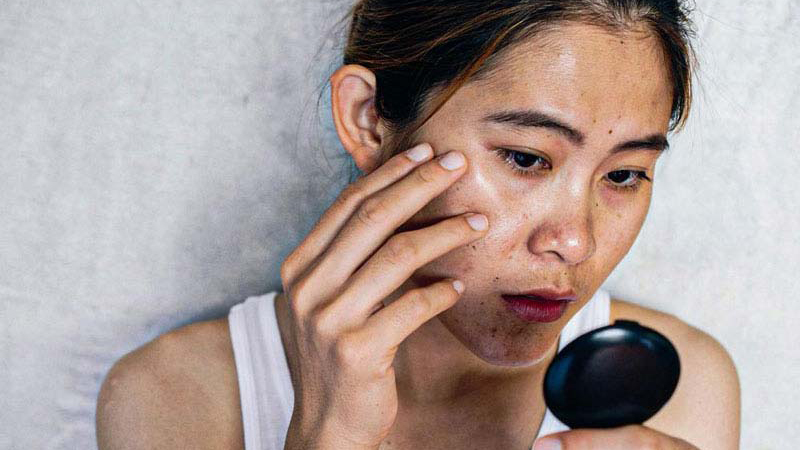 Dầu dưỡng da mặt​ là gì? Hướng dẫn chị em chọn sản phẩm phù hợp từng loại da 4