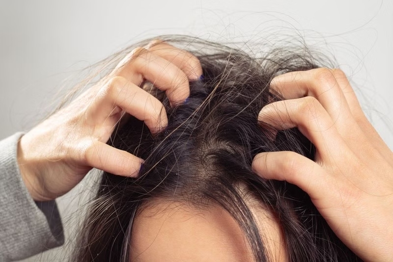 Dầu gội thảo dược thường chứa thành phần dịu nhẹ hơn, ít hóa chất tẩy rửa mạnh nên giảm nguy cơ kích ứng da đầu