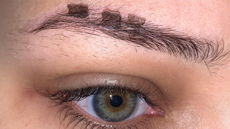 dau-hieu-bong-long-may-va-cach-de-long-may-bong-nhanh-hon 1.jpg