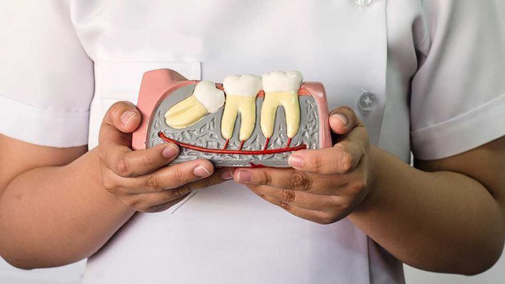 Dấu hiệu mọc răng khôn và trường hợp cần phải nhổ 1