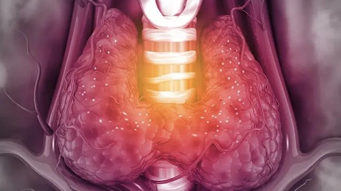 dau-hieu-suy-tim-nang-va-nhung-dieu-can-luu-y 2