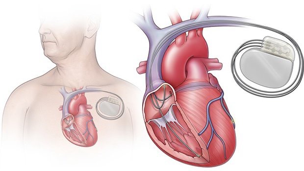 dau-hieu-suy-tim-nang-va-nhung-dieu-can-luu-y 6