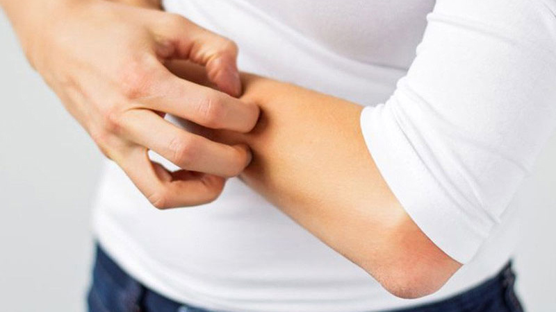 Dấu hiệu tăng men gan nhất định bạn phải biết 1