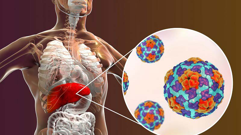 Dấu hiệu tăng men gan nhất định bạn phải biết 2