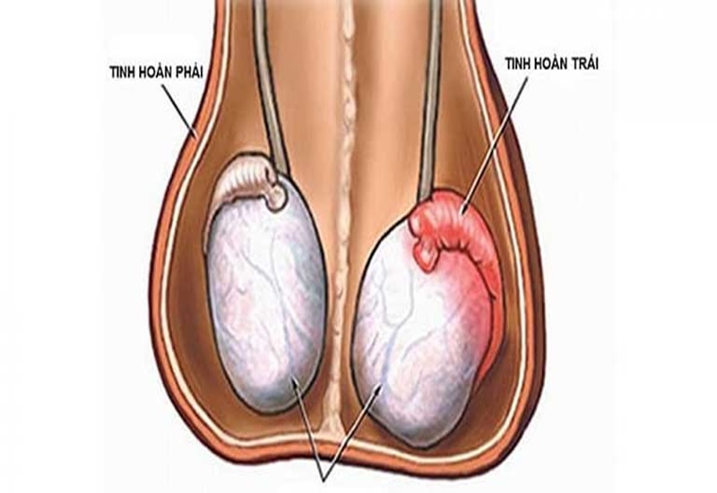 Dấu hiệu và cách điều trị rối loạn nội tiết tố 3