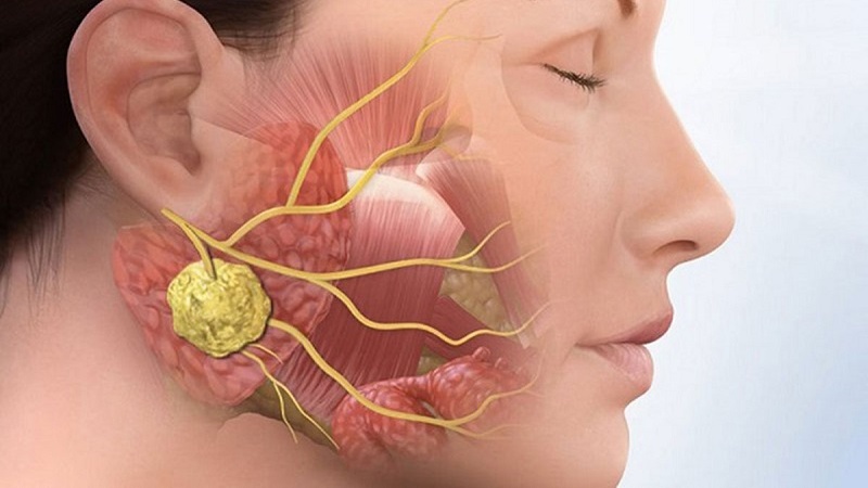 Hình ảnh ung thư xương quai hàm: Hiểu rõ bệnh để điều trị sớm 1