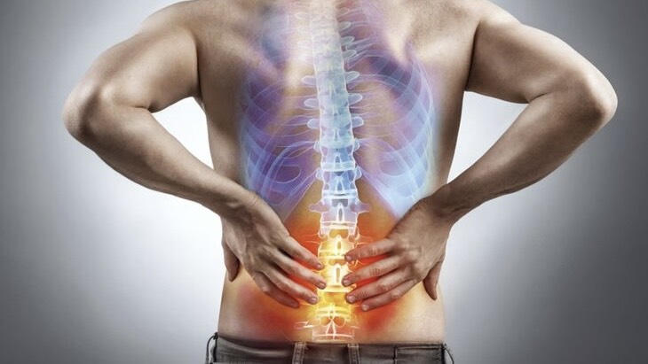 dau-than-kinh-toa-la-gi-nhan-biet-va-doi-pho-voi-nhung-con-dau-nhuc 1