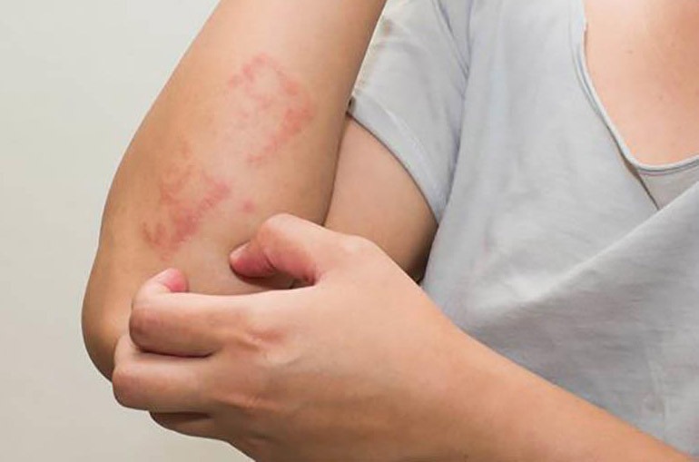 di-ung-con-trung-dot-phai-lam-sao 1.jpg