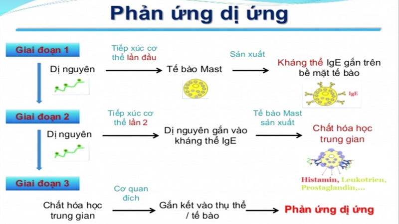Dị ứng động vật có vỏ: Triệu chứng, nguyên nhân và cách xử trí 3