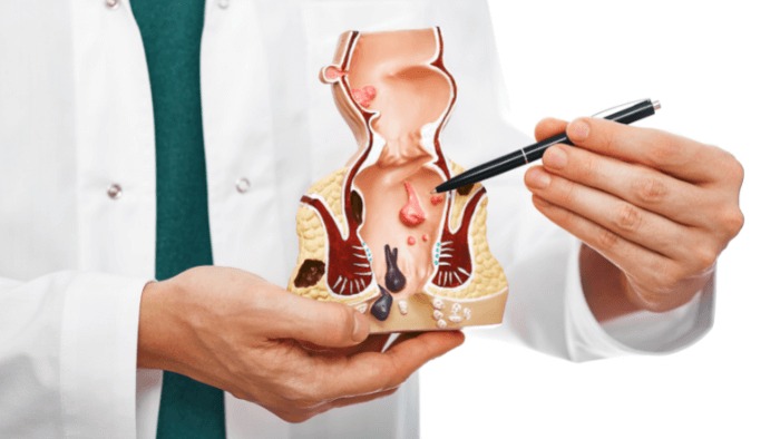 dia-chi-cat-tri-o-dau-tot-nhat-ha-noi 1.jpg