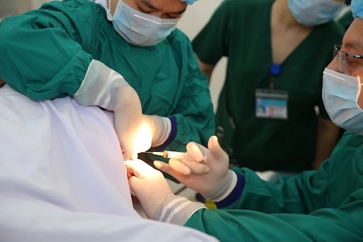 dia-chi-cat-tri-o-dau-tot-nhat-ha-noi 2.jpg