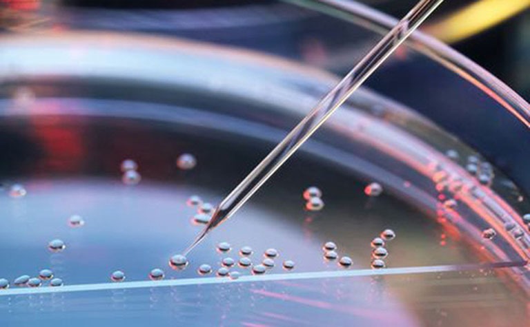 dieu-tri-tu-ky-bang-te-bao-goc-hua-hen-mang-lai-ket-qua-dang-mong-doi 1.jpg