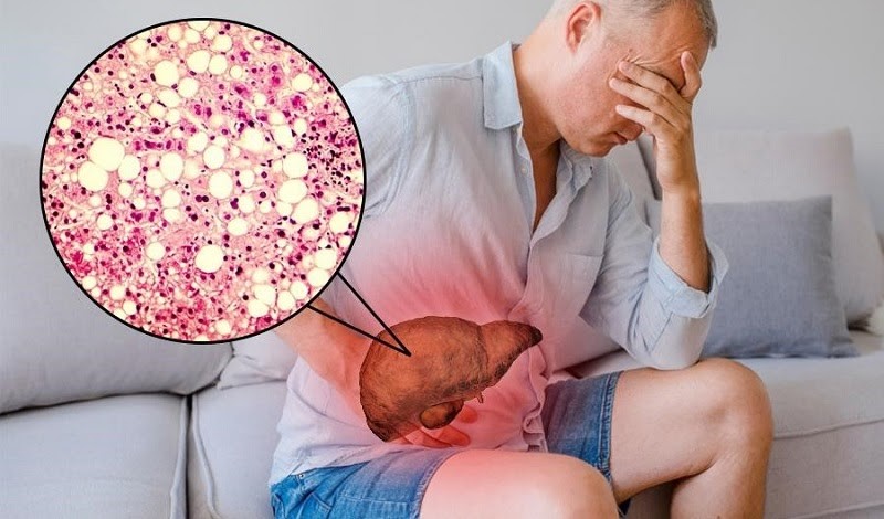 Dinh dưỡng tĩnh mạch hoàn toàn là như thế nào? 4