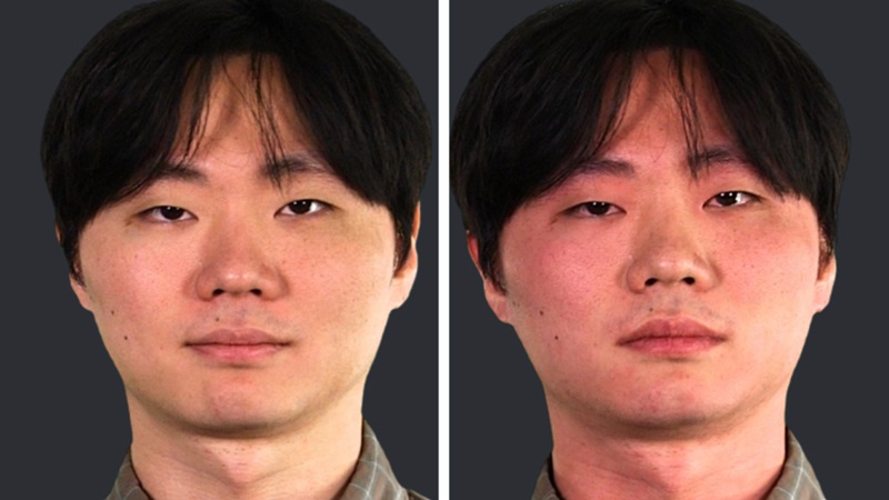 Đỏ mặt: Khái niệm, nguyên nhân và giải pháp can thiệp 2