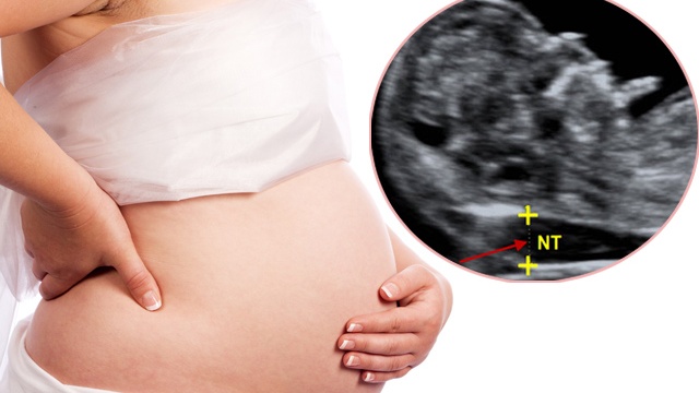 Độ mờ da gáy 0.9 mm có bình thường không?Độ mờ da gáy 0.9 mm có bình thường không? 3