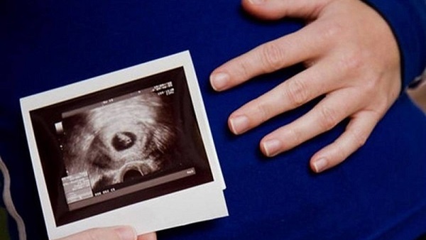 Độ mờ da gáy 0.9 mm có bình thường không? 4