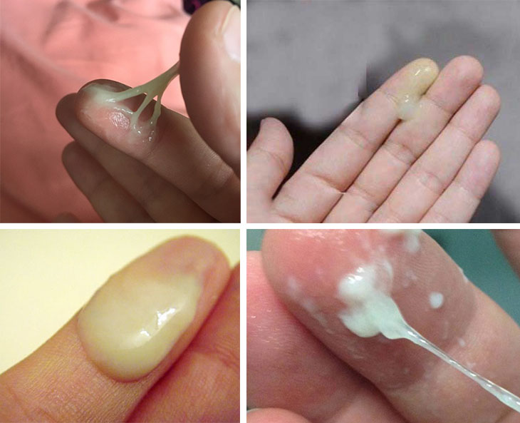 Đọc kết quả soi tươi huyết trắng như thế nào? 2