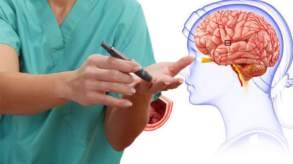 dot-quy-o-benh-nhan-tieu-duong-co-nguy-hiem-khong 3