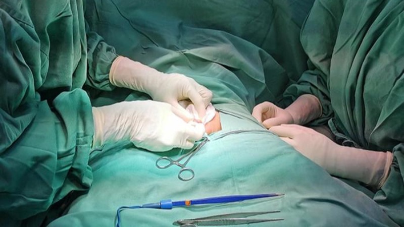 Đứt dây hãm bao quy đầu có sao không? 4