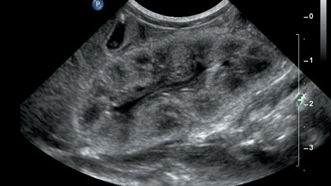 echo-than-la-gi-va-duọc-chi-dinh-trong-truong-hop-nao 1.jpg