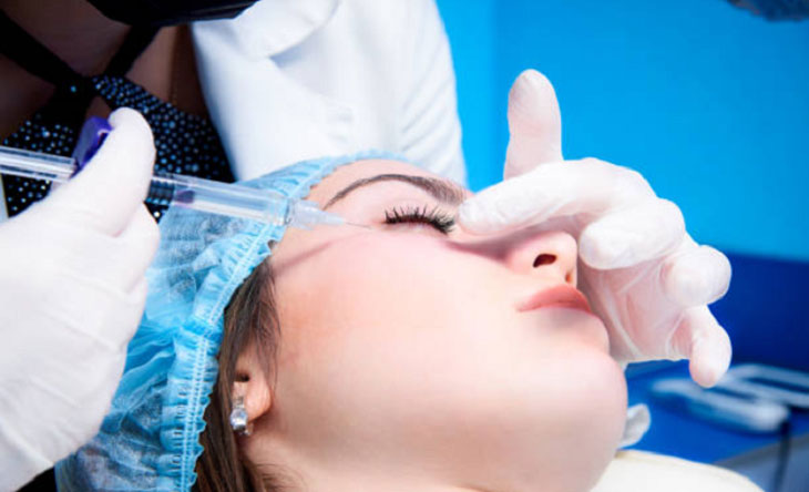 Filler là gì? Những điều nhất định phải biết trước và sau tiêm filler 4