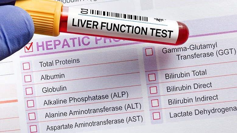 Gan nhiễm mỡ có nguy hiểm không? 5 biến chứng của bệnh gan nhiễm mỡ ai cũng cần biết 4