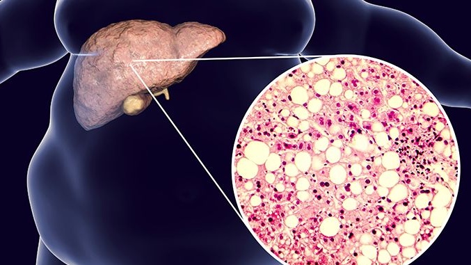 gan-to-co-chua-duoc-khong 3