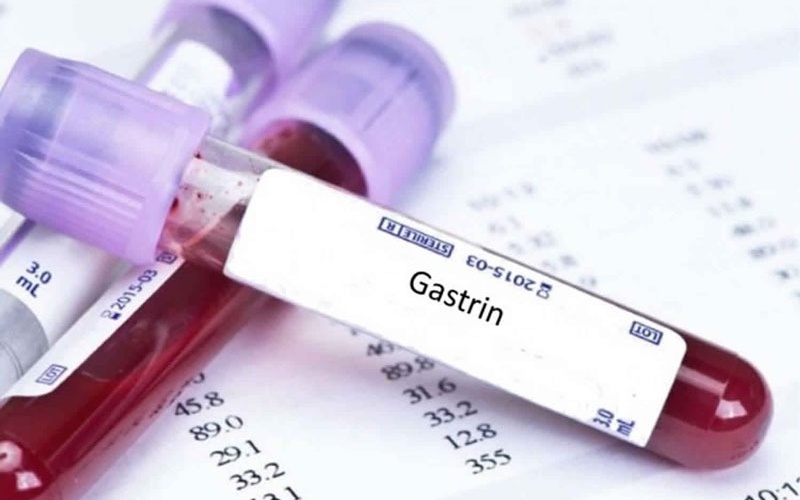 gastrin-hormone-la-gi-vai-tro-cua-gastrin-hormone 2.jpg