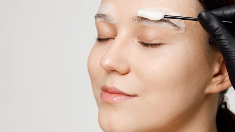 Gàu ở lông mày: Nguyên nhân và cách khắc phục hiệu quả 4