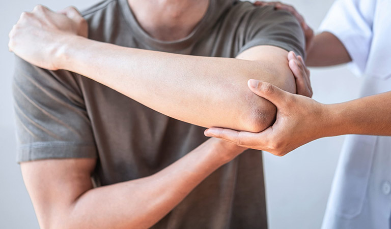 Gãy mỏm khuỷu đơn độc có triệu chứng gì? Cách điều trị ra sao? 2