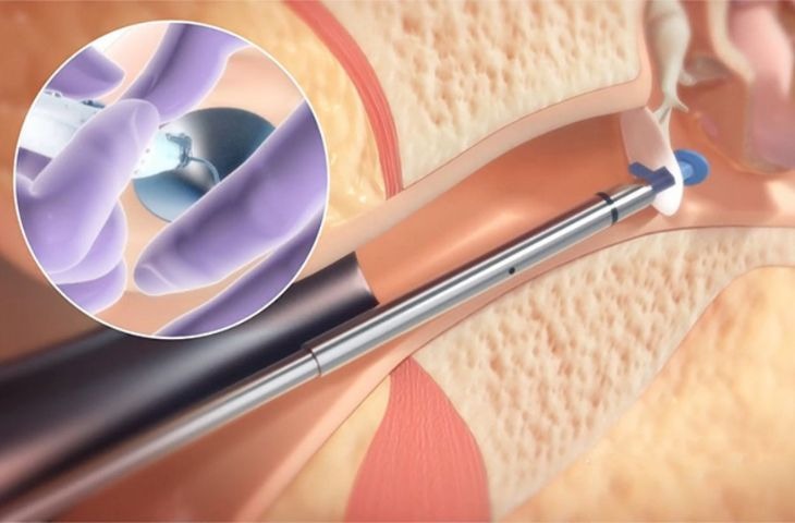 gia-dat-ong-thong-khi-tai-bao-nhieu-tien 1.jpg