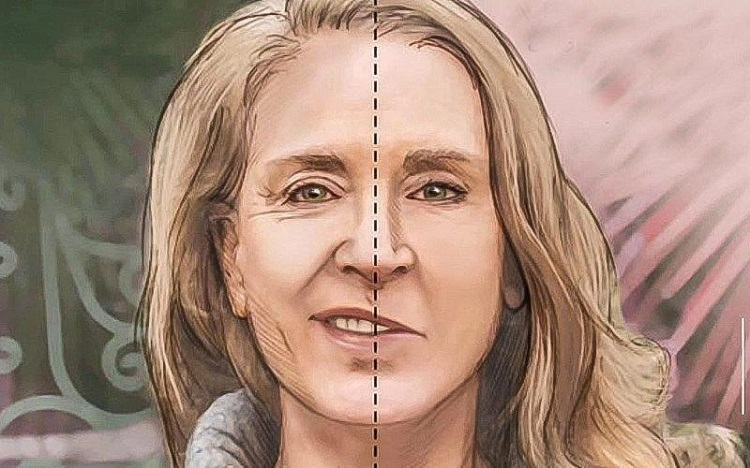 Giải đáp: bệnh xơ vữa động mạch gây hậu quả gì? 3