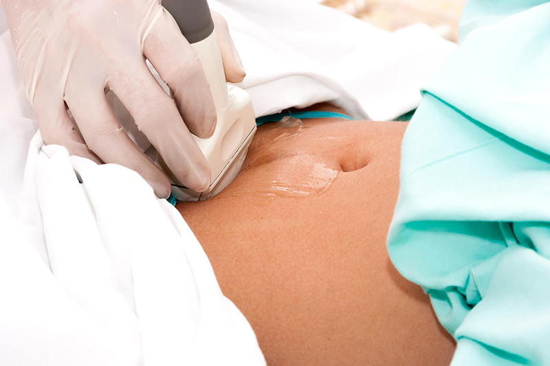 Giải đáp: Bị u nang buồng trứng siêu âm có phát hiện ra không? 3