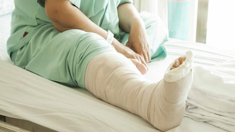 Giải đáp: Biến chứng xương không lành sau gãy và những dấu hiệu xương không lành dễ nhận biết 4