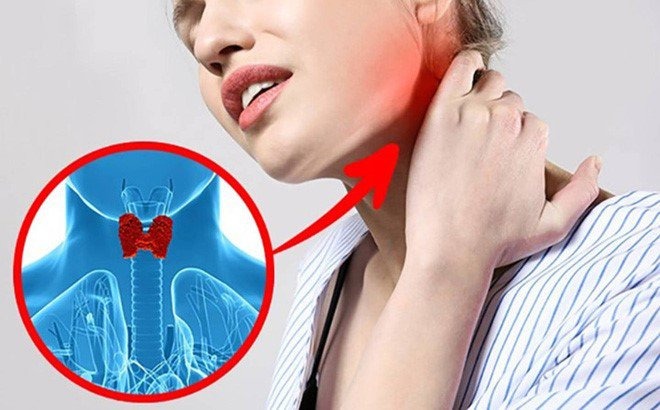 Giải đáp: Húng quế có tác dụng chữa tuyến giáp hay không? 1
