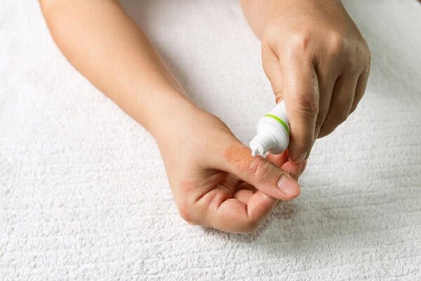 giai-dap-kien-ba-khoang-can-boi-acyclovir-duoc-khong 3.jpg