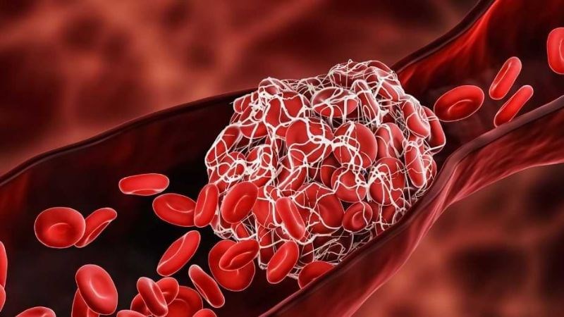 Giải đáp: Nghệ đen có tác dụng gì? Những điều cần biết trước khi sử dụng 4