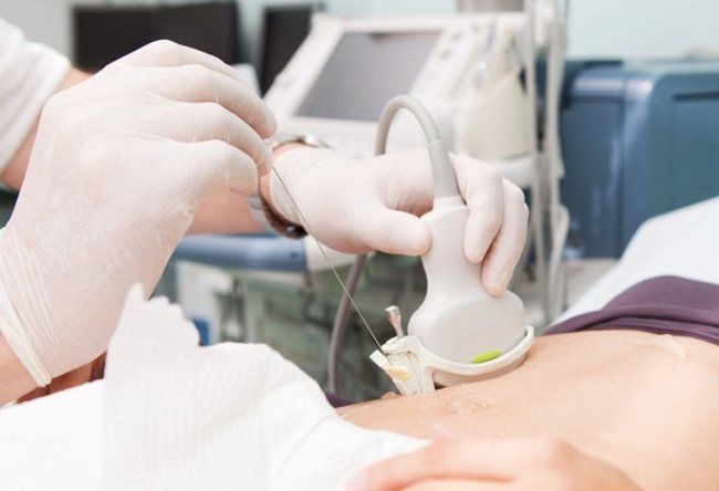 Giải đáp: Sinh thiết tế bào ung thư có nguy hiểm không? 3