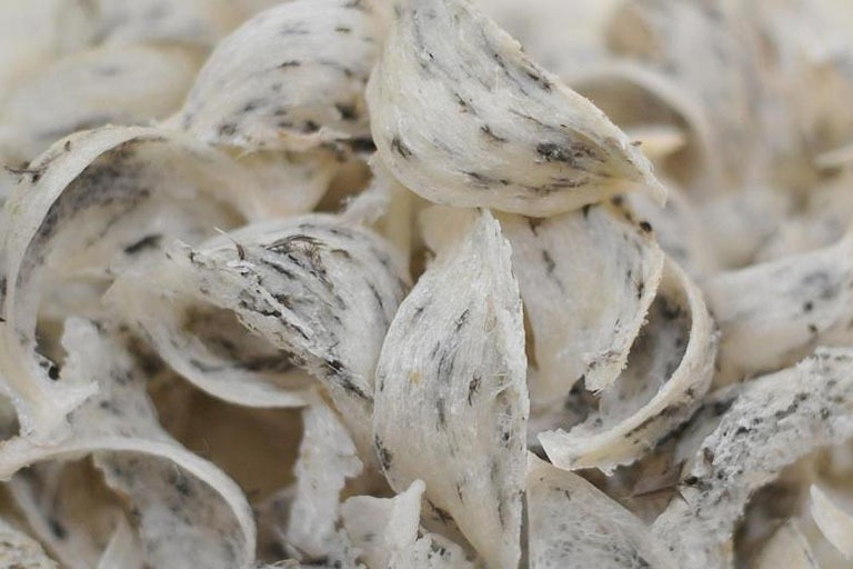 Giải đáp thắc mắc: Bệnh nhân suy thận có ăn yến được không?1